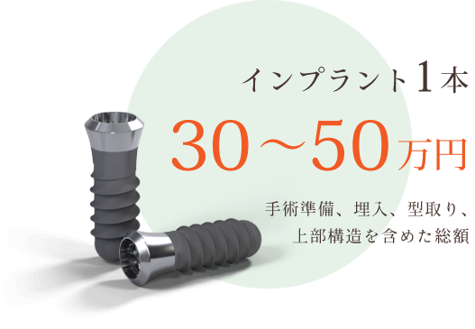 インプラント1本 30〜50万円 手術準備、埋入、型取り、上部構造を含めた総額